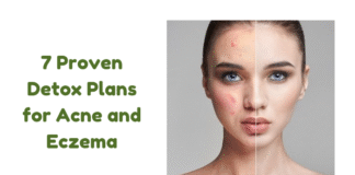 7 Proven Detox Plans for Acne and Eczema